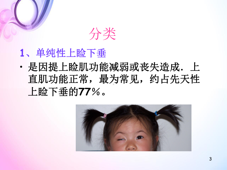 上睑下垂的诊断与治课件.ppt_第3页