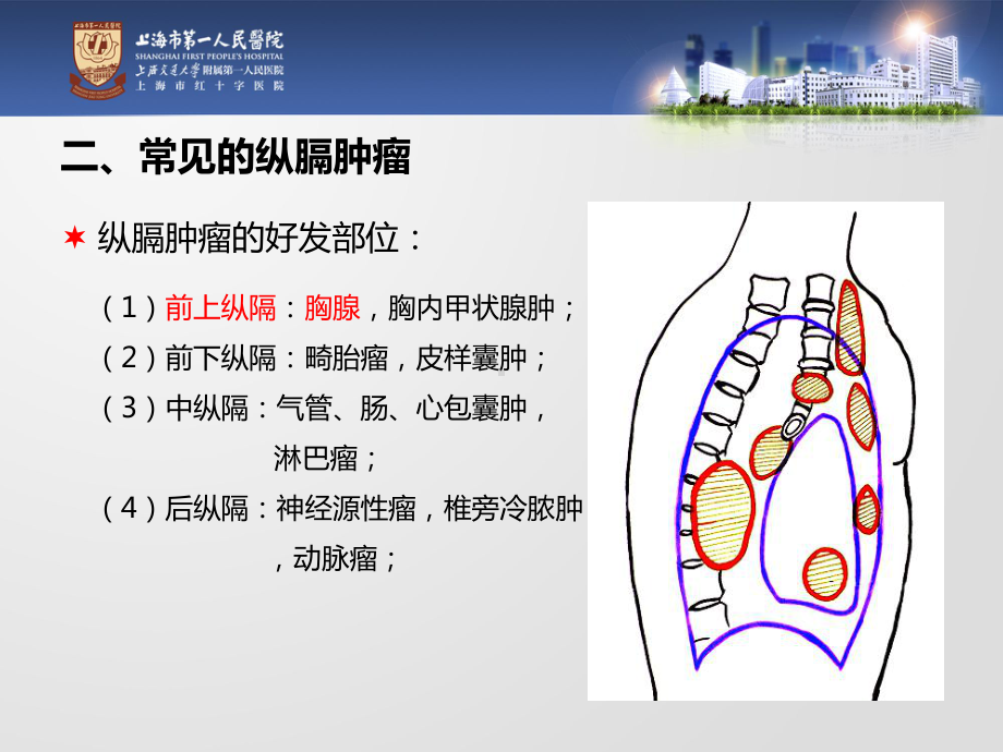 纵膈肿瘤临床表现及围手术期护理课件.ppt_第3页