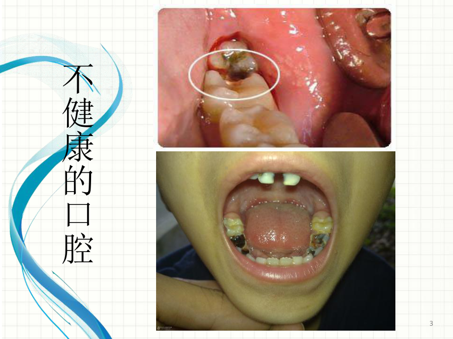 中学生口腔健康知识教学课件.pptx_第3页