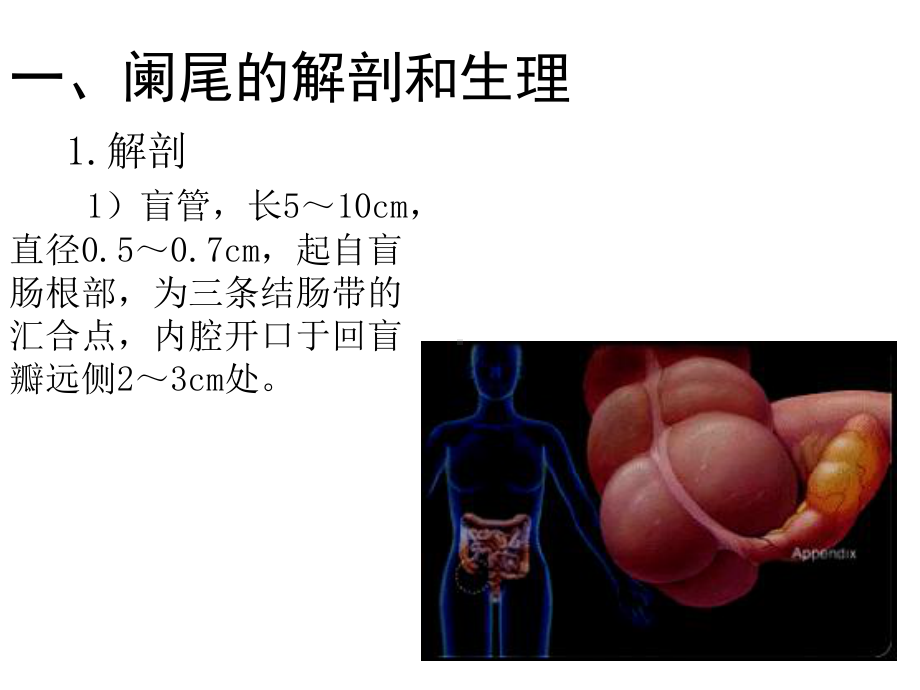 急性阑尾炎教学查房PT课件.ppt_第3页