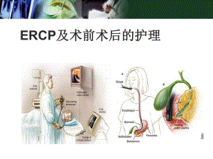 新版ERCP及术前术后护理课件.pptx