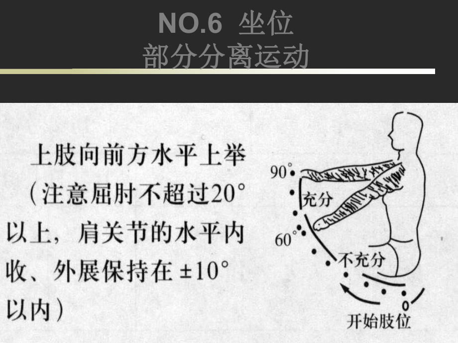 上田敏式偏瘫功能分级课件-.ppt_第1页