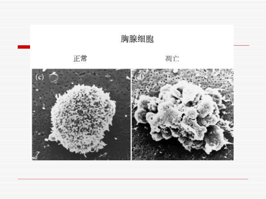 细胞凋亡的DNA琼脂糖凝胶电泳课件.ppt_第3页