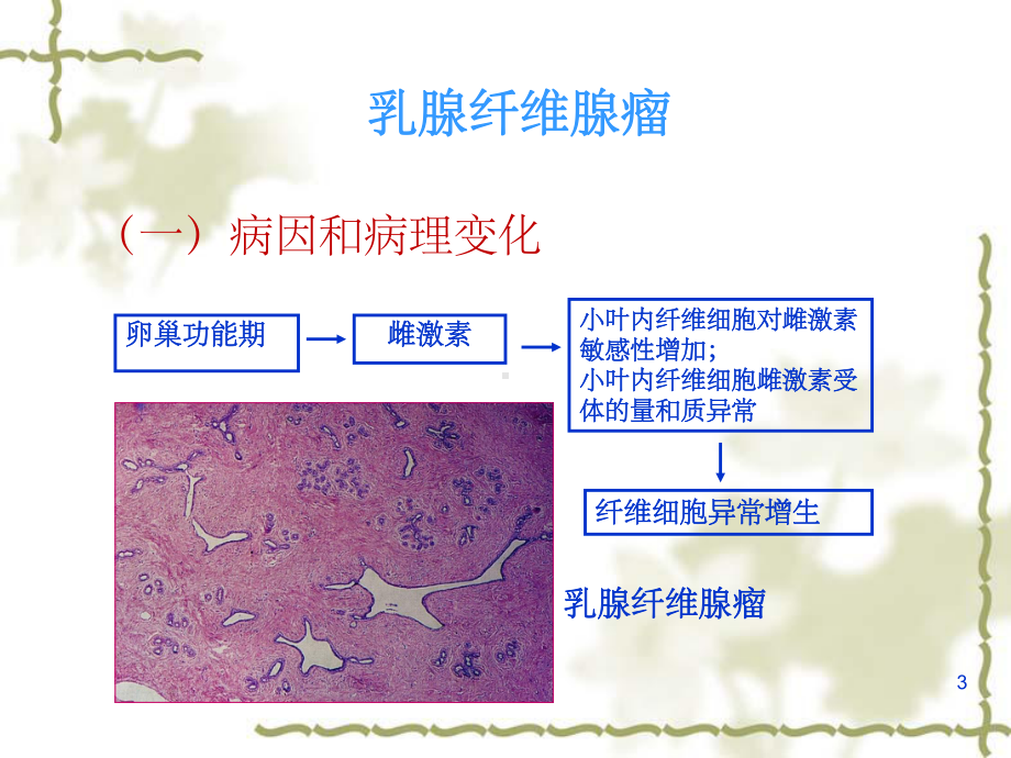 常见乳腺肿瘤的影像表现课件.ppt_第3页