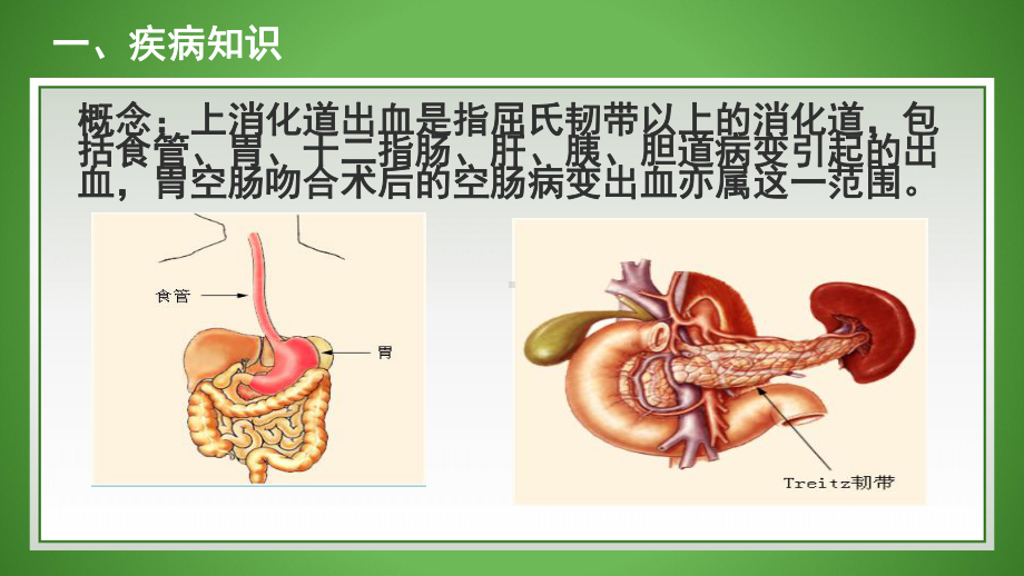 上消化道出血知识讲解课件.pptx_第3页