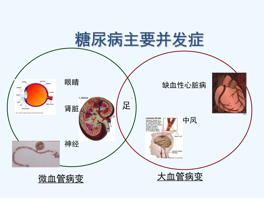 糖尿病健康教育之饮食课件.ppt_第3页