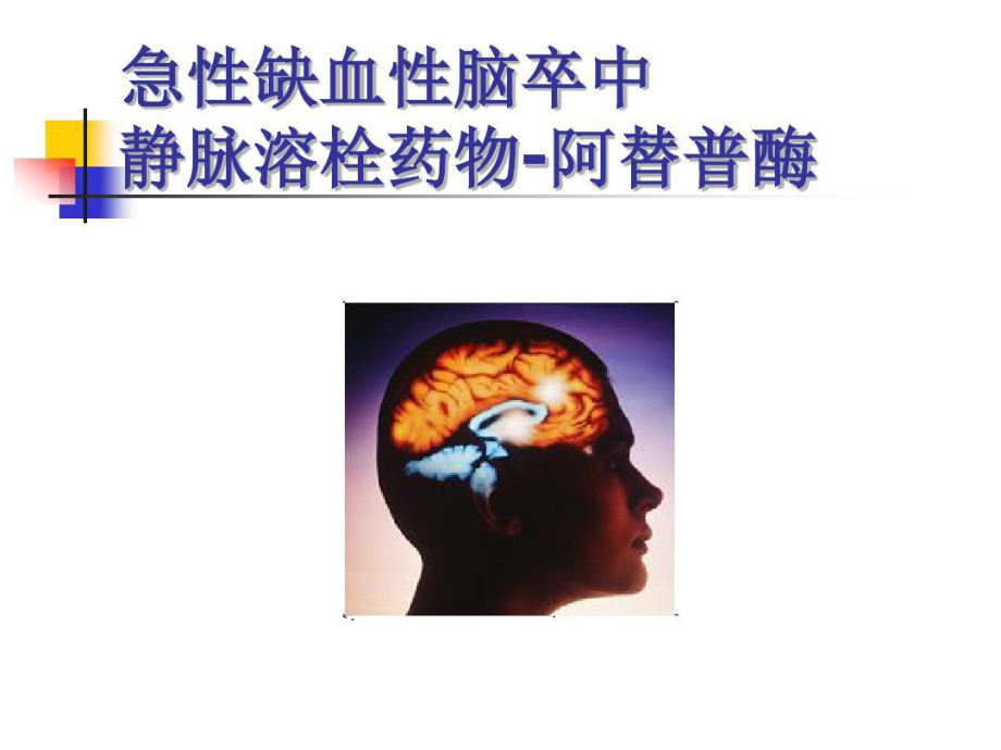 急性缺血性脑卒中静脉溶栓药物-阿替普酶课件.ppt_第1页