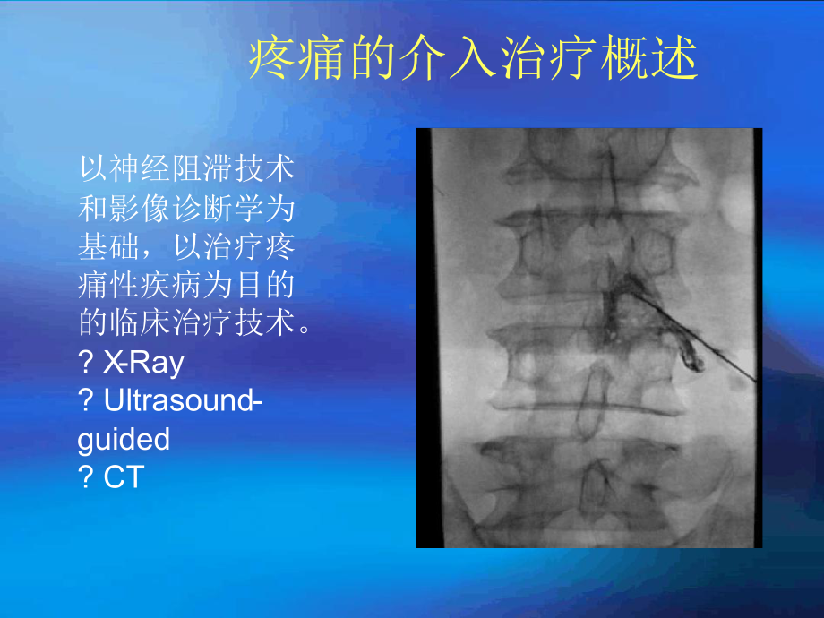 疼痛的介入治疗课件.ppt_第3页