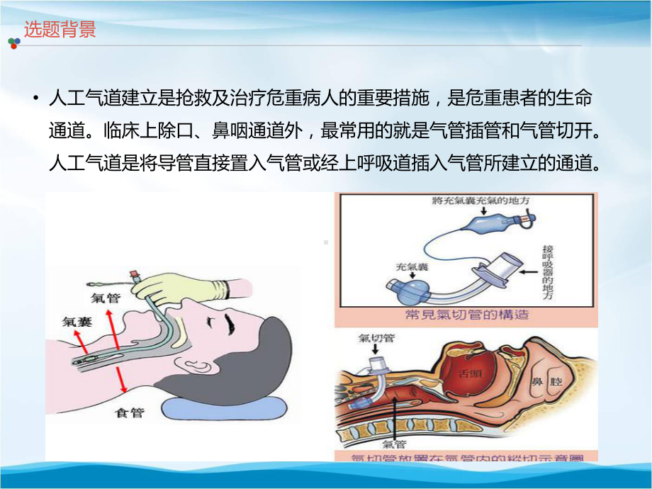 提高人工气道气囊管理正确率品管圈汇报书模板课件.pptx_第2页