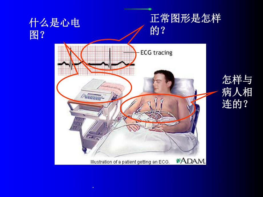 心电图的基础知识最新版课件.ppt_第2页