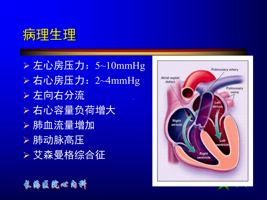 房间隔缺损介入治疗[001]课件.ppt_第3页