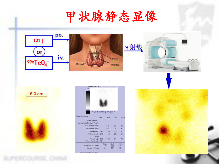 内分泌系统-核医学教学课件.ppt_第3页