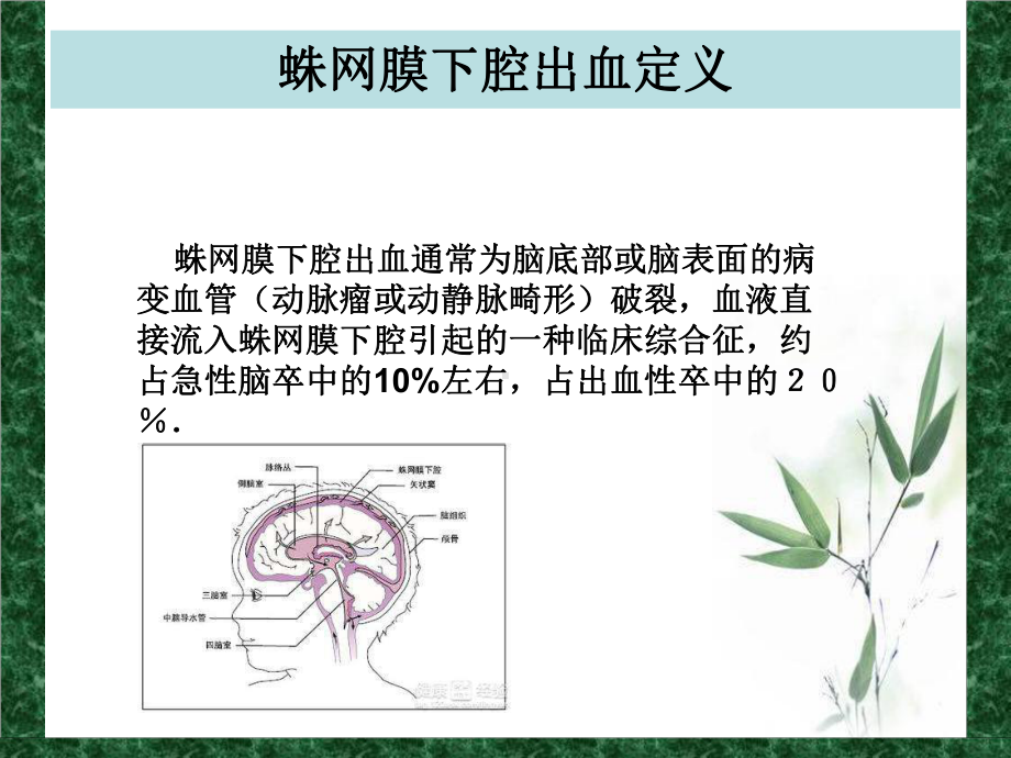 护理查房蛛网膜下腔出血课件.ppt_第3页