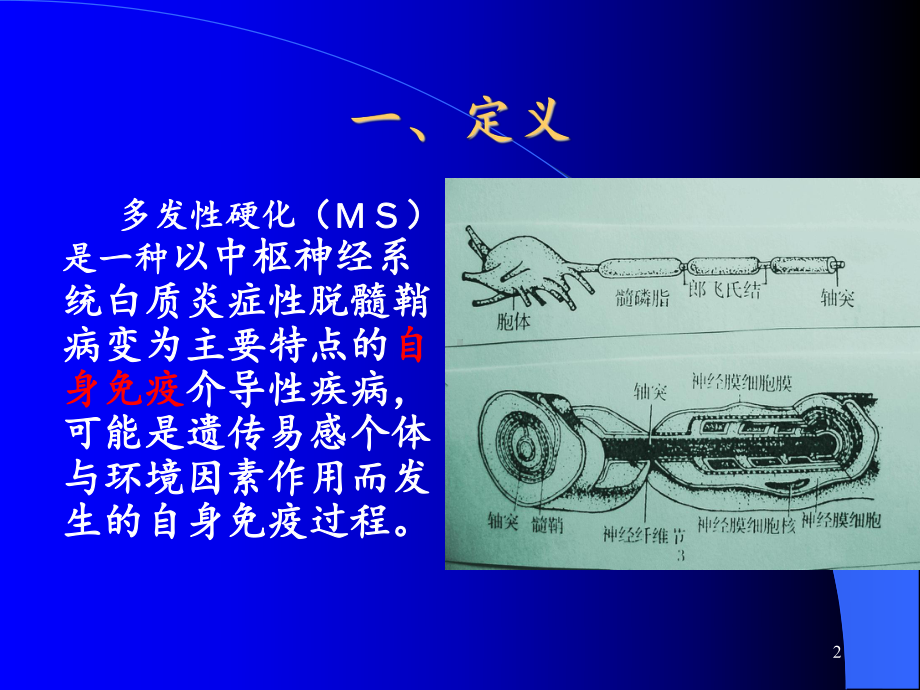 多发性硬化学习课件.ppt_第2页