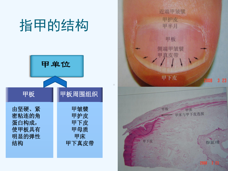 常见皮肤病指甲表现课件.ppt_第1页