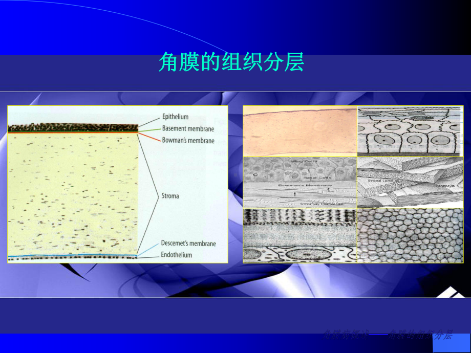 眼病学课件-07角膜病(有动画效果).ppt_第3页