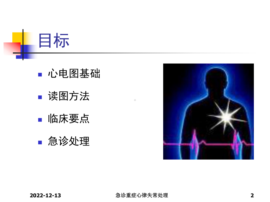 急诊重症心律失常处理课件.ppt_第2页