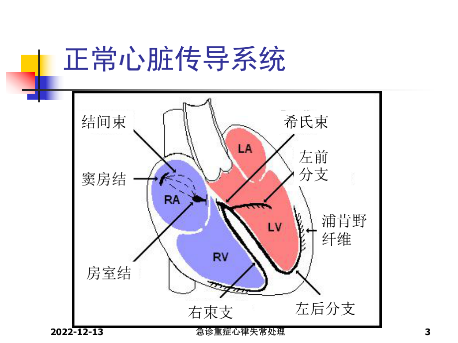 急诊重症心律失常处理课件.ppt_第3页