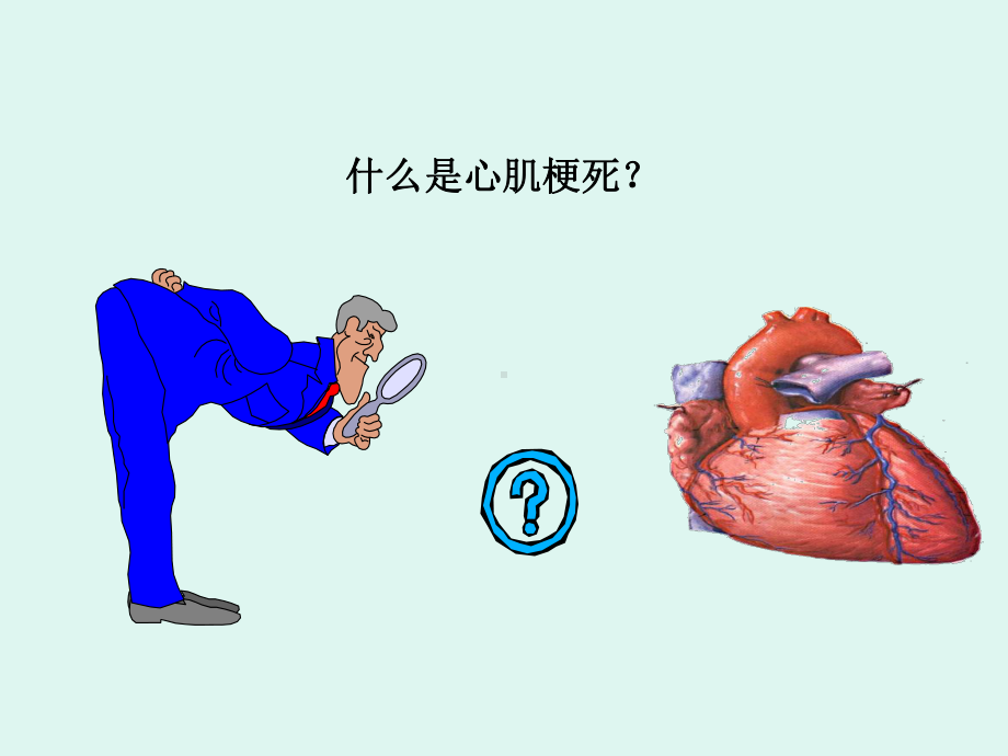 心肌梗死的诊治流程课件.ppt_第3页