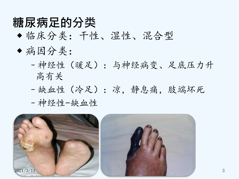 糖尿病足的预防与治疗课件.pptx_第3页