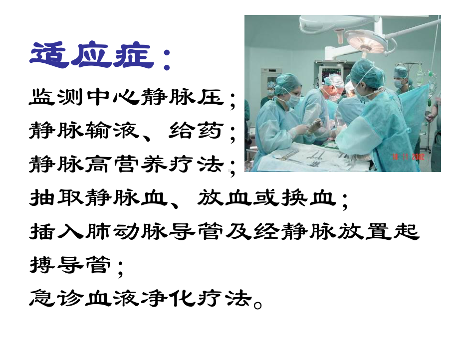 深静脉穿刺置管术及CVP的测量解析课件.ppt_第3页