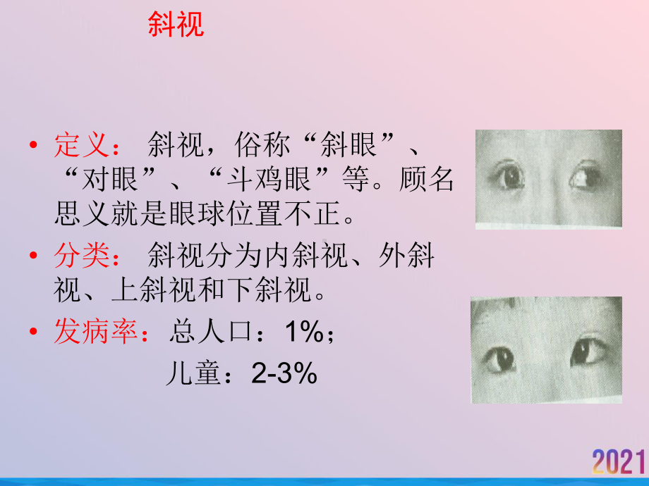 眼科专业知识与技能培训眼外肌病2021推荐课件.ppt_第3页