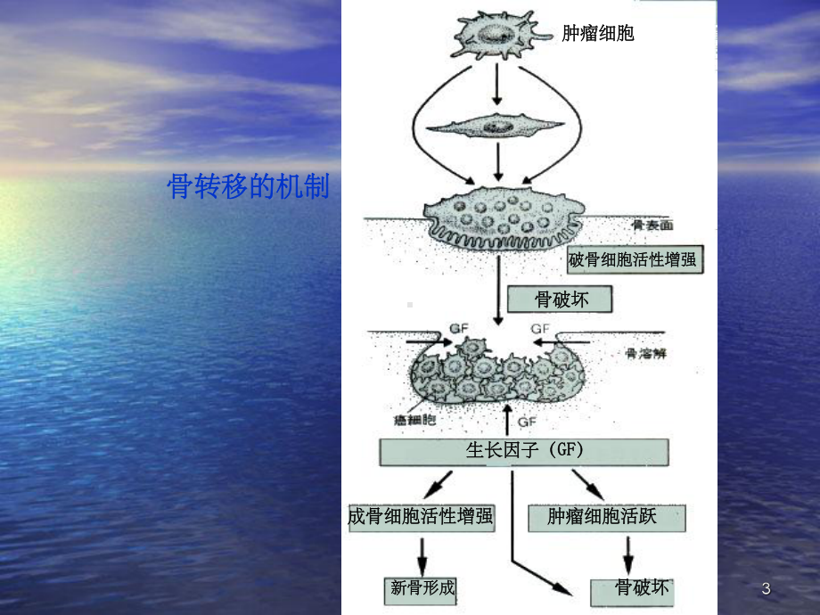 核医学骨关节显像课件.ppt_第3页