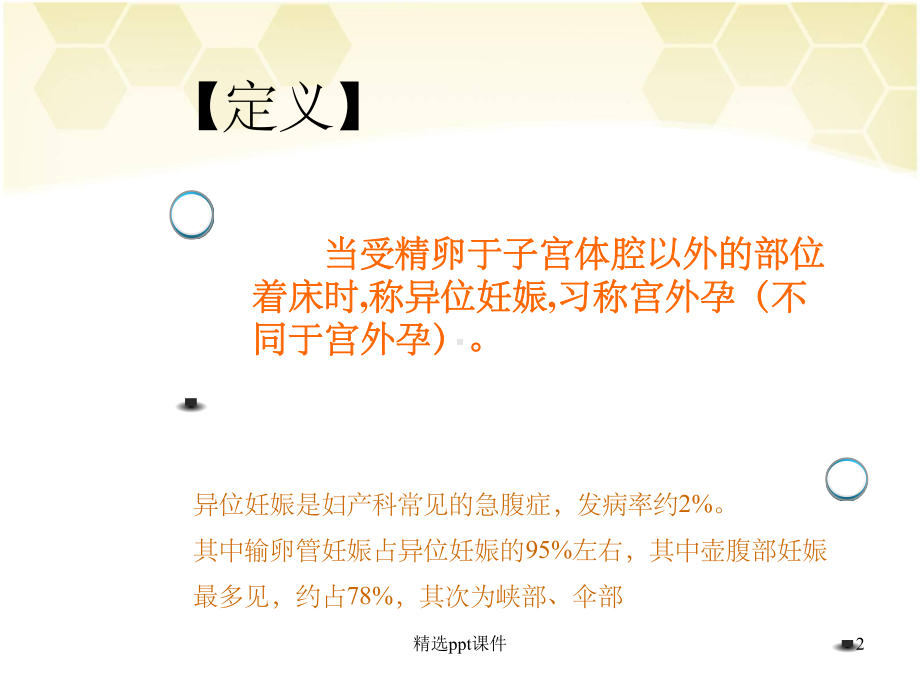 异位妊娠的护理课件1.ppt_第2页