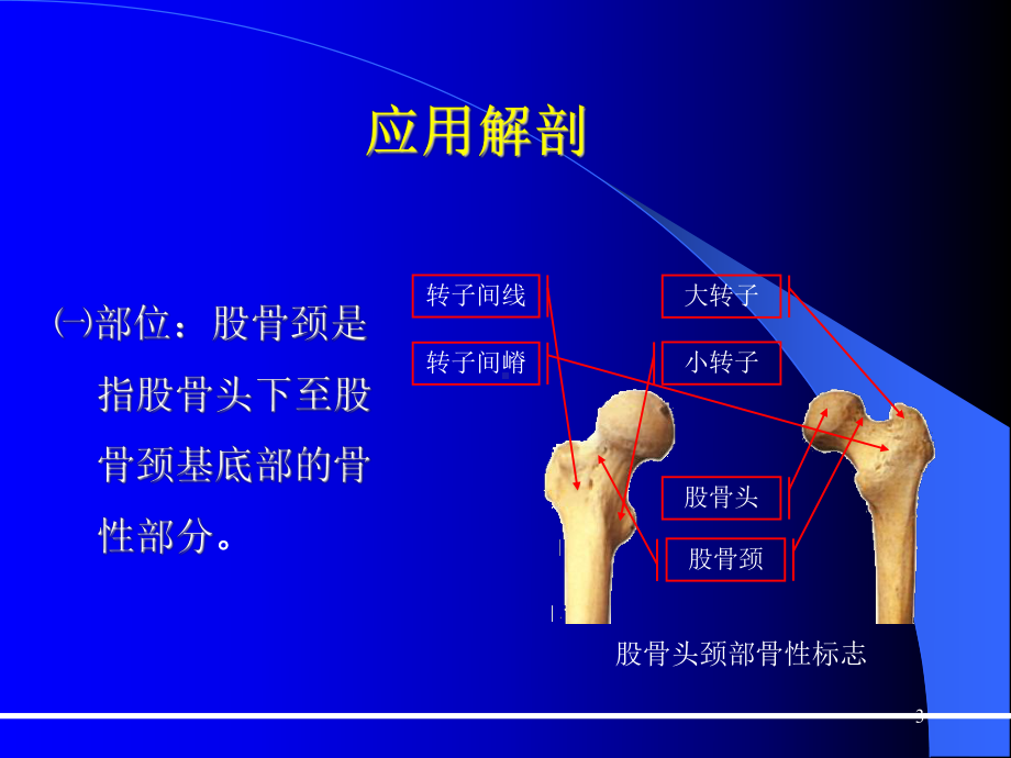 股骨颈骨折教案课件.ppt_第3页