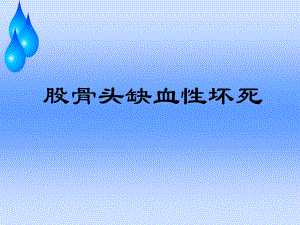 股骨头缺血性坏死护理查房研究课件.ppt