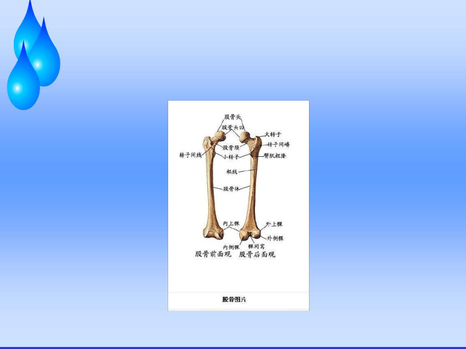 股骨头缺血性坏死护理查房研究课件.ppt_第3页