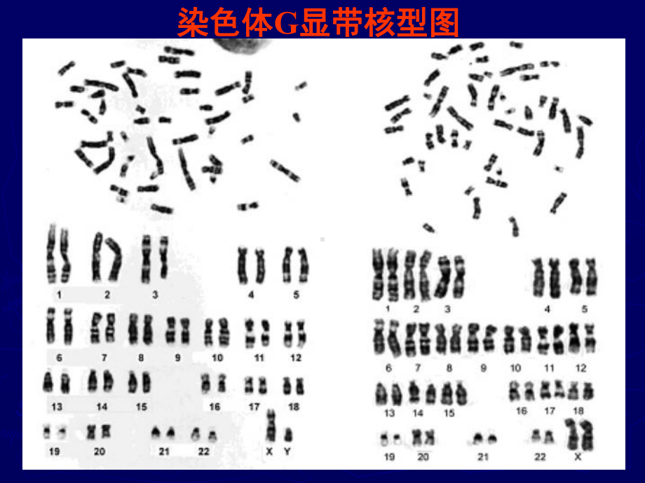 染色体G显带技术及其原理课件.pptx_第1页