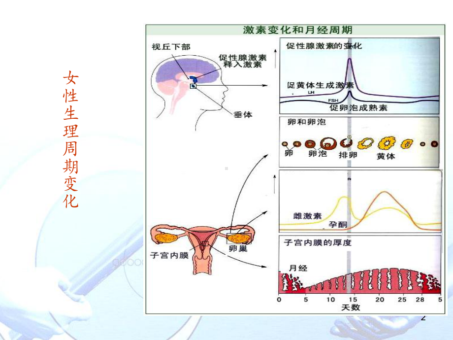 多囊卵巢综合征（妇产科）-课件.ppt_第2页