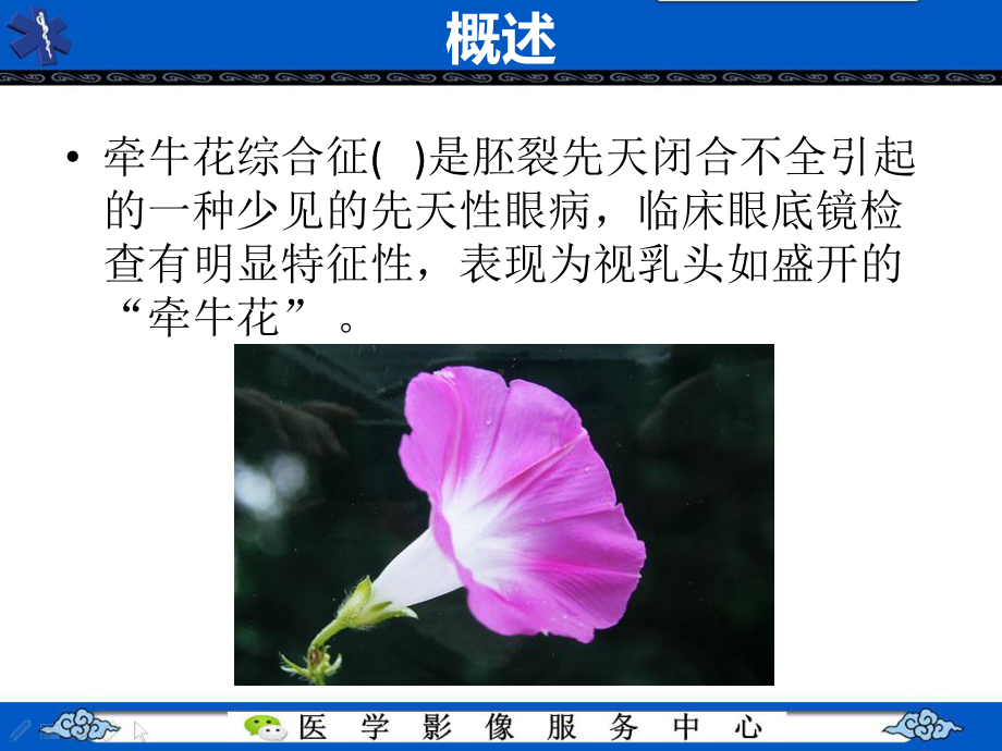 牵牛花综合征的影像学表现课件.pptx_第3页