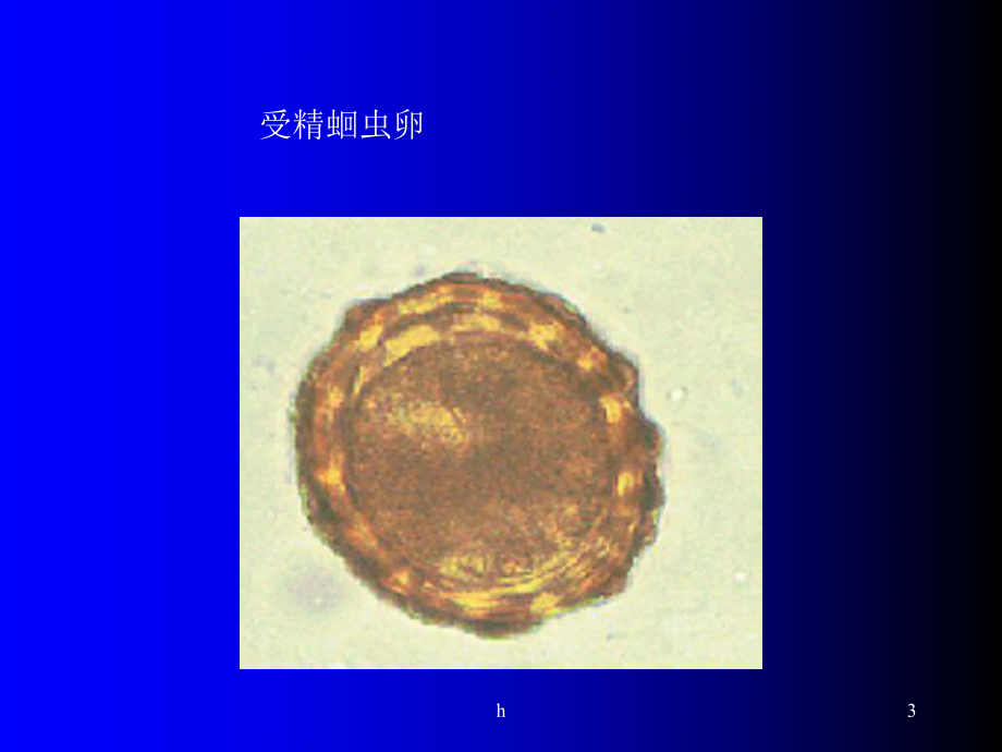 寄生虫实验全部图片复习课件.ppt_第3页