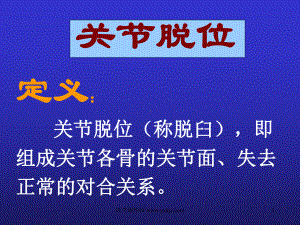 关节脱位定义关节脱位称脱臼即组成关节各骨的关节面失去正常课件.ppt