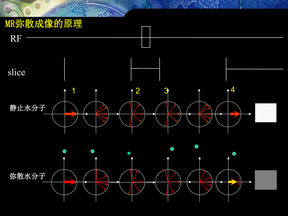 磁共振弥散加权成像原理及应用课件.ppt_第3页