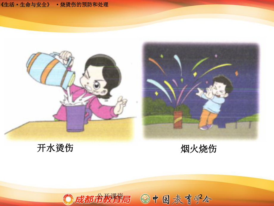 烧烫伤的预防和处理(学习课资)课件.ppt_第2页