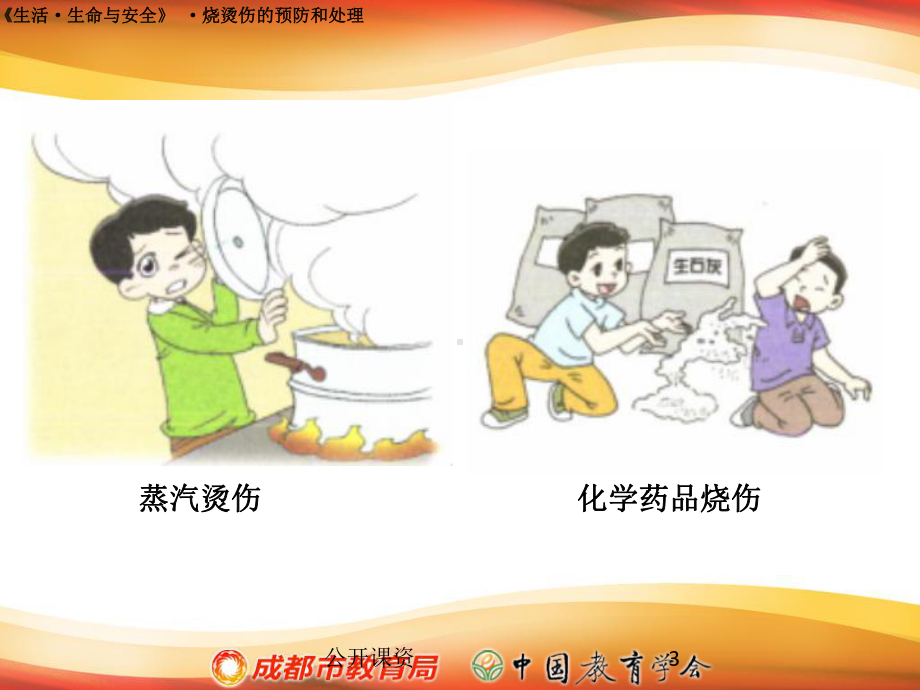 烧烫伤的预防和处理(学习课资)课件.ppt_第3页