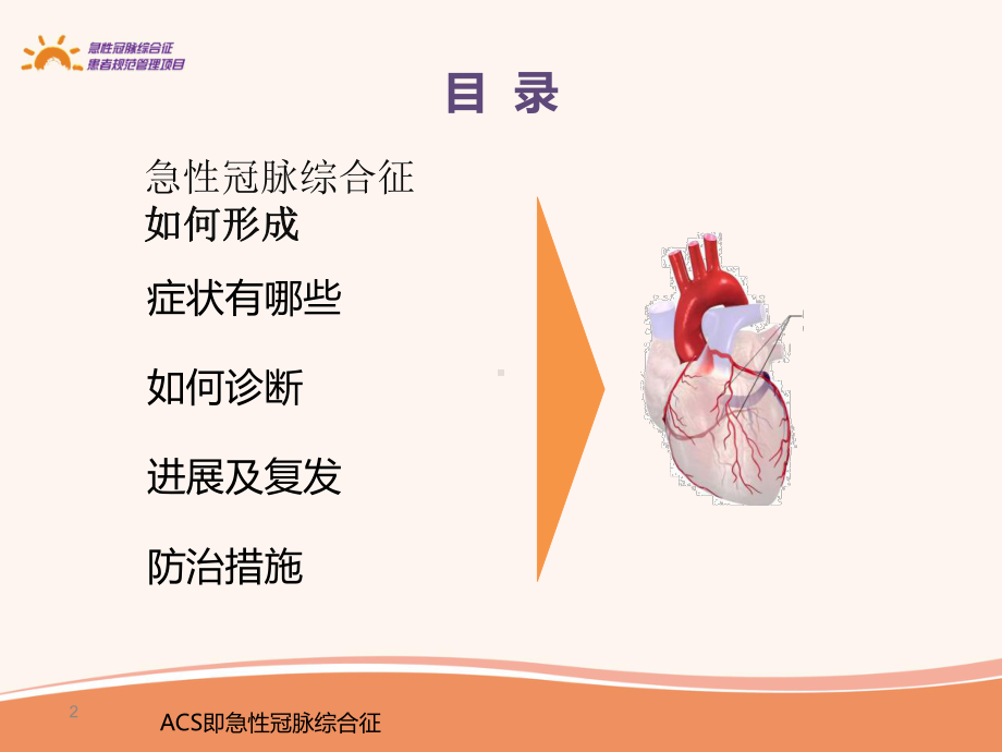 急性冠脉综合征疾病知识及生活防治措施课件.pptx_第2页