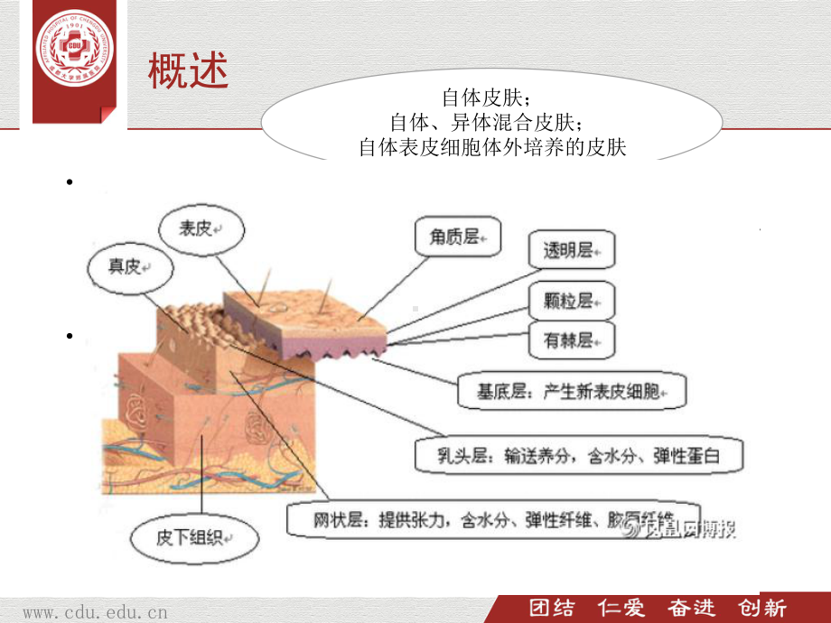 植皮病人围手术期护理课件.pptx_第3页