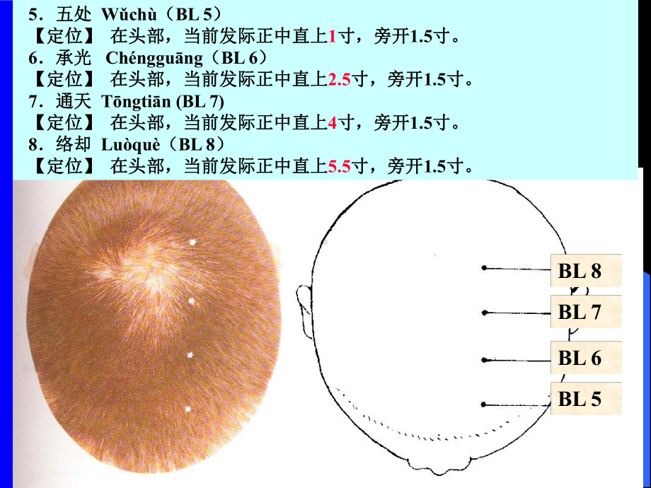 经络学-足太阳经络与腧穴课件.ppt_第3页