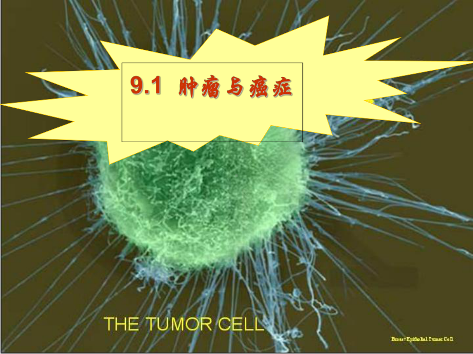 第九章肿瘤与癌基因课件.ppt_第2页