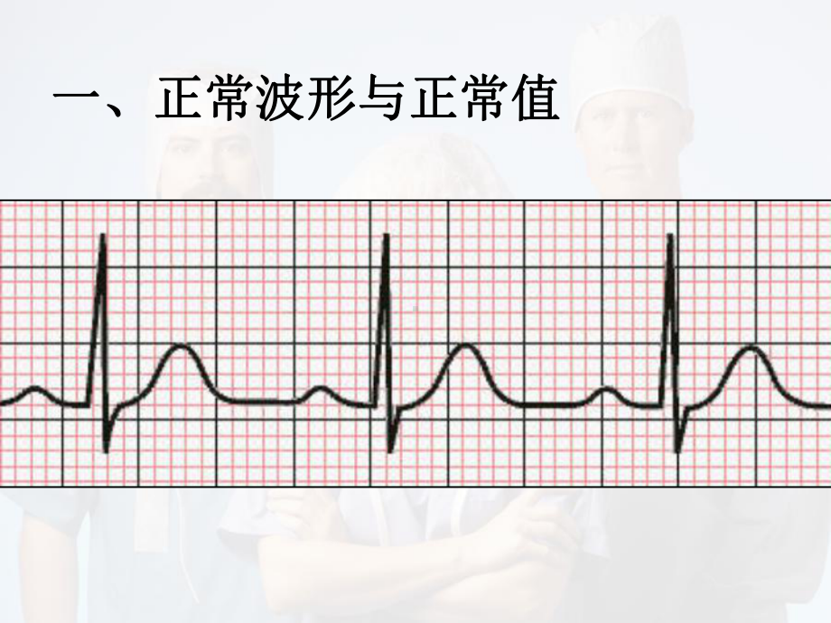 心电图解读教学课件.ppt_第3页