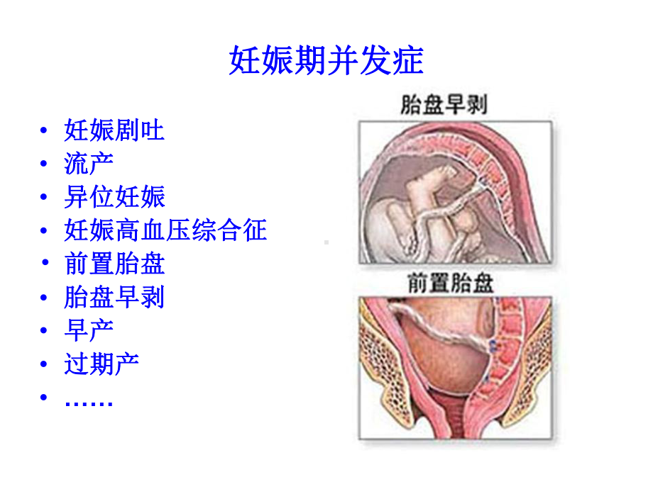 妊娠合并症、并发症的识别和处理课件.ppt_第2页