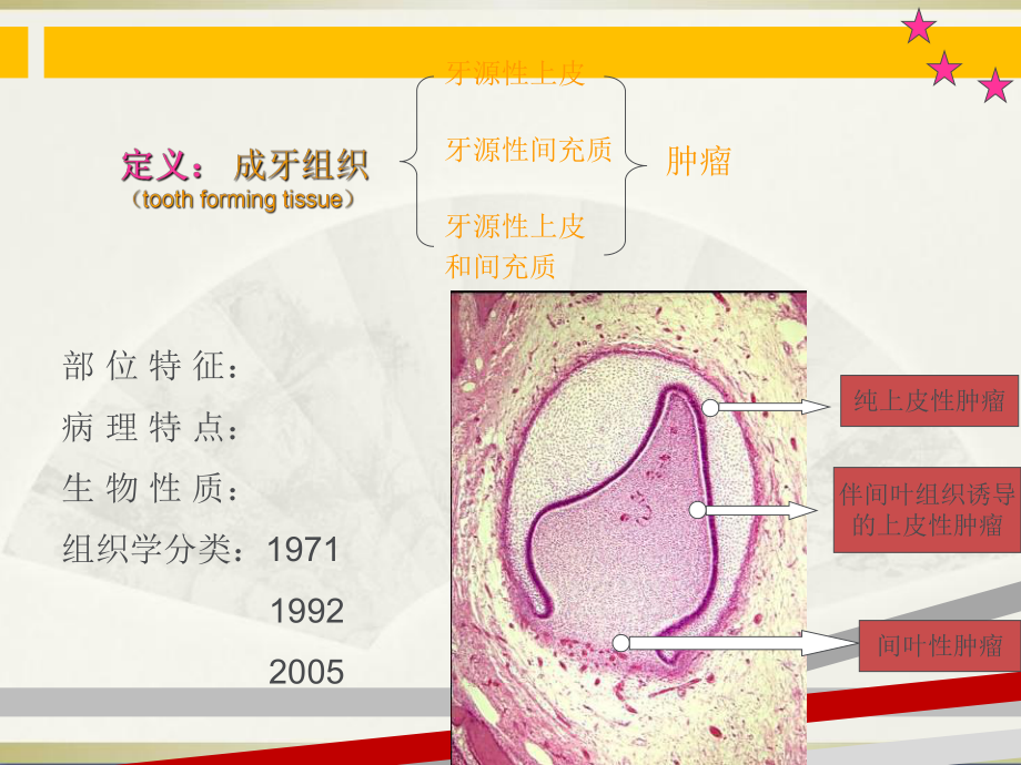 第18章-牙源性肿瘤和瘤样病变课件.ppt_第3页