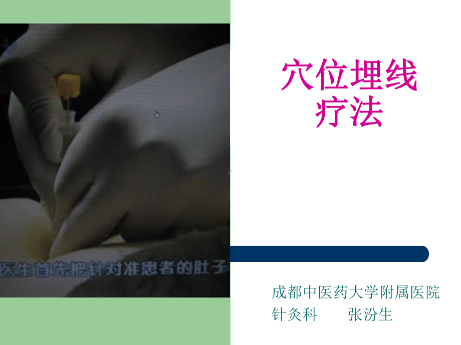 减肥穴位埋线疗法课件.ppt_第1页