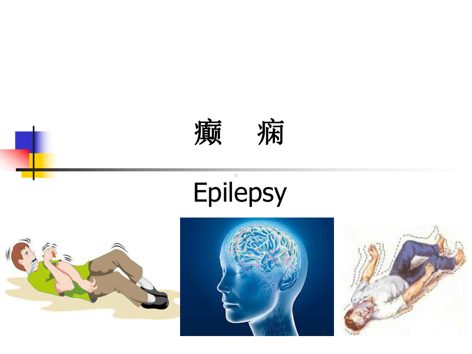 癫痫解说医学课件.ppt_第3页