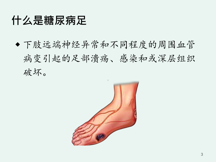 糖尿病足的预防与治疗课件.ppt_第3页