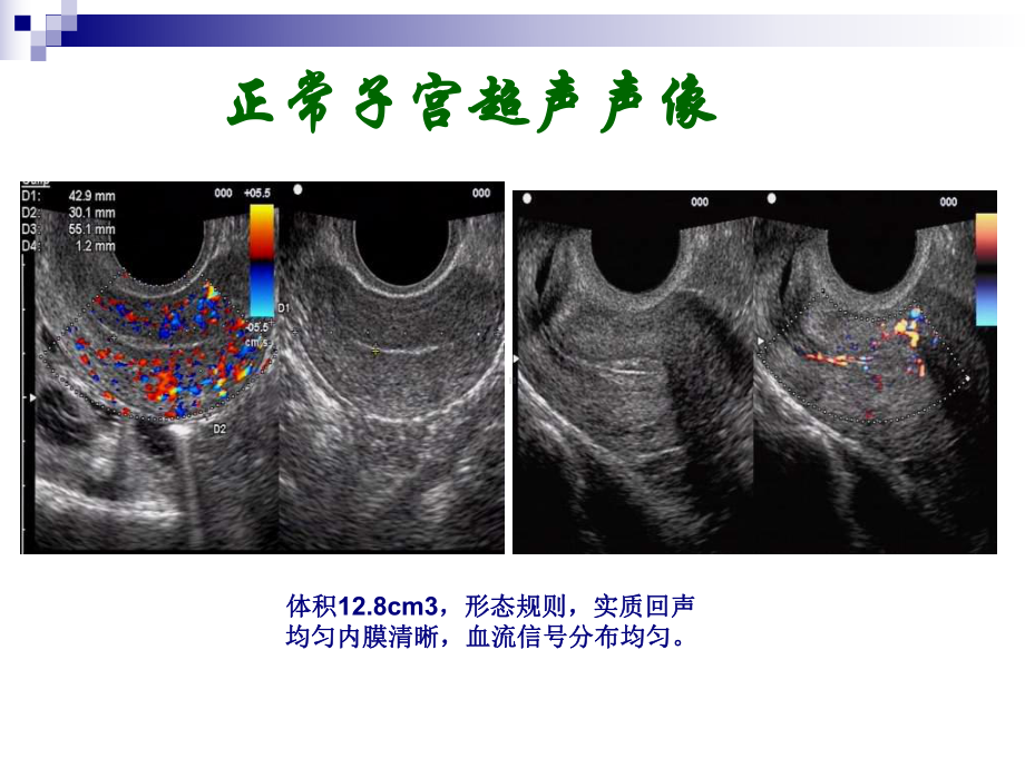 妇科超声常规检查风险评估课件.pptx_第3页